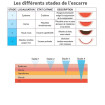 Matelas Invcare Softform Premier Original